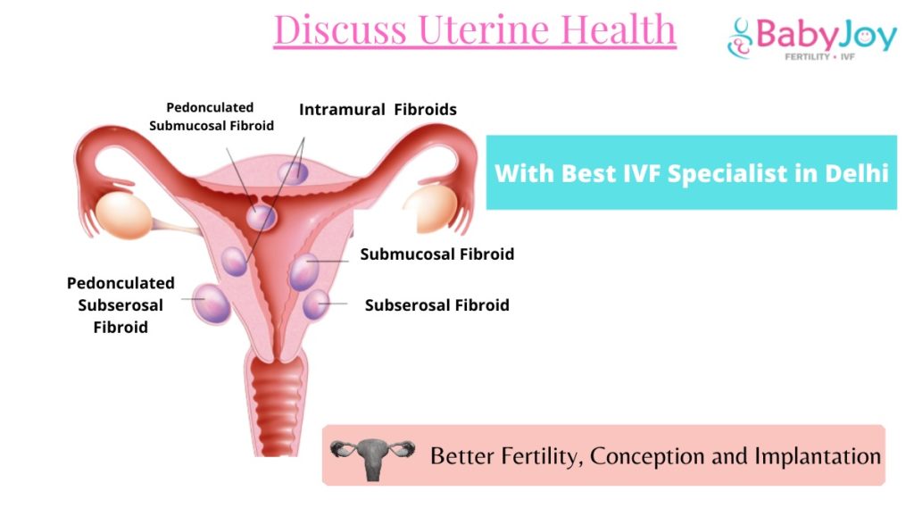IVF Specialist in Delhi