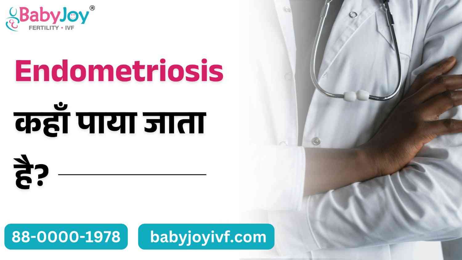 एंडोमेट्रियोसिस ( Endometriosis ) कहाँ पाया जाता है?