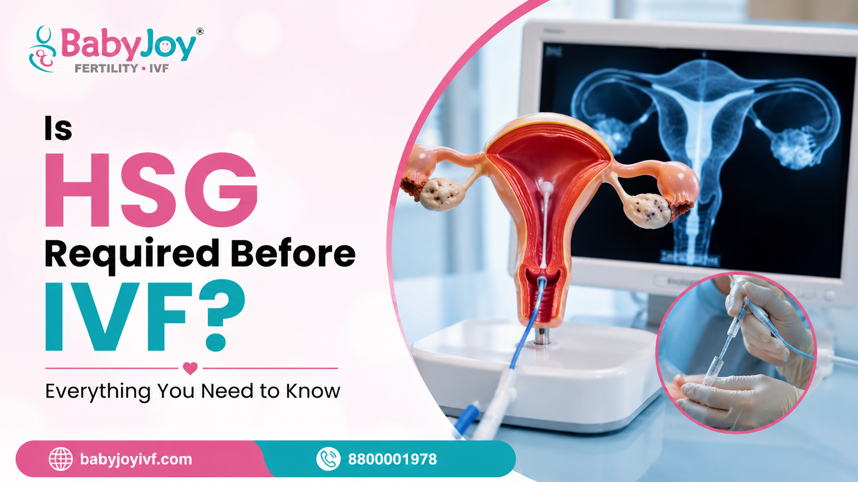 Is HSG Required Before IVF Everything You Need to Know